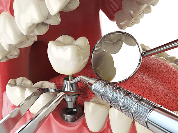 Best Broken or Cracked Tooth Emergency Dentist in Point Pleasant, NJ